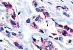 ESRRB Antibody in Immunohistochemistry (Paraffin) (IHC (P))