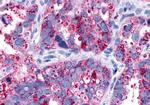 PAR2 Antibody in Immunohistochemistry (Paraffin) (IHC (P))