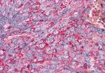 FZD1 Antibody in Immunohistochemistry (Paraffin) (IHC (P))