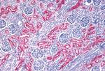 FZD10 Antibody in Immunohistochemistry (Paraffin) (IHC (P))