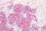 FZD7 Antibody in Immunohistochemistry (Paraffin) (IHC (P))