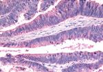 FZD7 Antibody in Immunohistochemistry (Paraffin) (IHC (P))