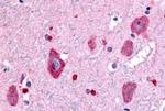 GABBR1 Antibody in Immunohistochemistry (Paraffin) (IHC (P))