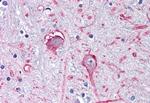 GABRA3 Antibody in Immunohistochemistry (Paraffin) (IHC (P))