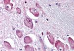 GABRA3 Antibody in Immunohistochemistry (Paraffin) (IHC (P))