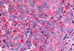 GALR2 Antibody in Immunohistochemistry (Paraffin) (IHC (P))