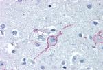 GALR3 Antibody in Immunohistochemistry (Paraffin) (IHC (P))