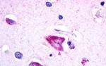 GALR3 Antibody in Immunohistochemistry (Paraffin) (IHC (P))