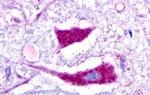 GALR3 Antibody in Immunohistochemistry (Paraffin) (IHC (P))