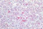 GnRHR Antibody in Immunohistochemistry (Paraffin) (IHC (P))