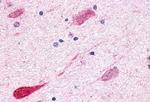 GPR1 Antibody in Immunohistochemistry (Paraffin) (IHC (P))