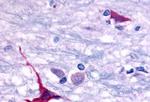 GPR101 Antibody in Immunohistochemistry (Paraffin) (IHC (P))