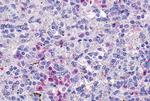 GPR109B Antibody in Immunohistochemistry (Paraffin) (IHC (P))