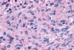 GPR139 Antibody in Immunohistochemistry (Paraffin) (IHC (P))