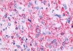 GPR143 Antibody in Immunohistochemistry (Paraffin) (IHC (P))