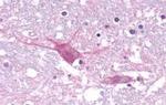 CRTH2 Antibody in Immunohistochemistry (Paraffin) (IHC (P))