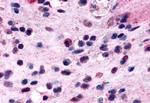 CRTH2 Antibody in Immunohistochemistry (Paraffin) (IHC (P))