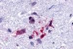 CRTH2 Antibody in Immunohistochemistry (Paraffin) (IHC (P))