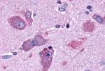 CRTH2 Antibody in Immunohistochemistry (Paraffin) (IHC (P))