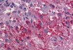 GPR56 Antibody in Immunohistochemistry (Paraffin) (IHC (P))