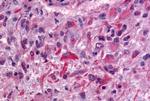 GPR64 Antibody in Immunohistochemistry (Paraffin) (IHC (P))