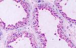 RAI3 Antibody in Immunohistochemistry (Paraffin) (IHC (P))