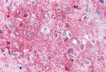 RAI3 Antibody in Immunohistochemistry (Paraffin) (IHC (P))