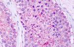 RAI3 Antibody in Immunohistochemistry (Paraffin) (IHC (P))