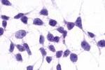 mGluR3 Antibody in Immunocytochemistry (ICC/IF)