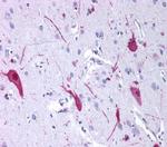 mGluR4 Antibody in Immunohistochemistry (Paraffin) (IHC (P))