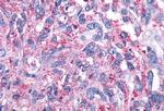 mGluR4 Antibody in Immunohistochemistry (Paraffin) (IHC (P))