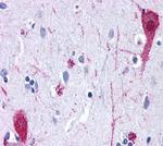 mGluR4 Antibody in Immunohistochemistry (Paraffin) (IHC (P))