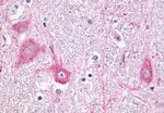 mGluR5 Antibody in Immunohistochemistry (Paraffin) (IHC (P))