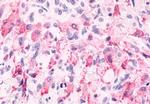 mGluR6 Antibody in Immunohistochemistry (Paraffin) (IHC (P))