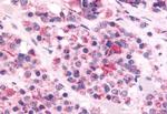 Orexin Receptor 1 Antibody in Immunohistochemistry (Paraffin) (IHC (P))