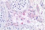 HRH4 Antibody in Immunohistochemistry (Paraffin) (IHC (P))