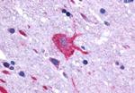 LGR4 Antibody in Immunohistochemistry (Paraffin) (IHC (P))