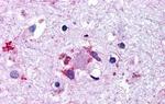 LGR6 Antibody in Immunohistochemistry (Paraffin) (IHC (P))