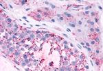 MAS1 Antibody in Immunohistochemistry (Paraffin) (IHC (P))