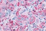 MAS1 Antibody in Immunohistochemistry (Paraffin) (IHC (P))