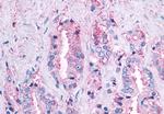 MAS1 Antibody in Immunohistochemistry (Paraffin) (IHC (P))