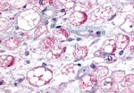 MCHR1 Antibody in Immunohistochemistry (Paraffin) (IHC (P))