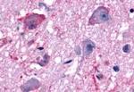 MCHR1 Antibody in Immunohistochemistry (Paraffin) (IHC (P))