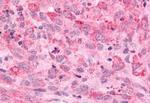 MINK1 Antibody in Immunohistochemistry (Paraffin) (IHC (P))