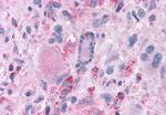 MRGPRX2 Antibody in Immunohistochemistry (Paraffin) (IHC (P))