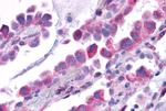 TACR1 Antibody in Immunohistochemistry (Paraffin) (IHC (P))