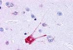 TACR1 Antibody in Immunohistochemistry (Paraffin) (IHC (P))