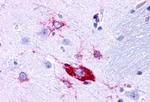 TACR1 Antibody in Immunohistochemistry (Paraffin) (IHC (P))