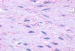 TACR2 Antibody in Immunohistochemistry (Paraffin) (IHC (P))