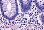 TACR2 Antibody in Immunohistochemistry (Paraffin) (IHC (P))